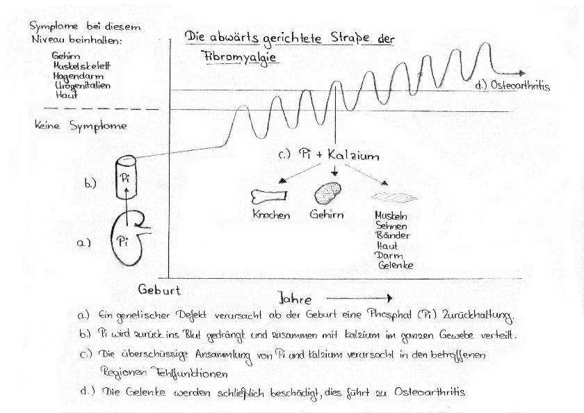 Zeichnung: Entstehung der Fibromyalgie